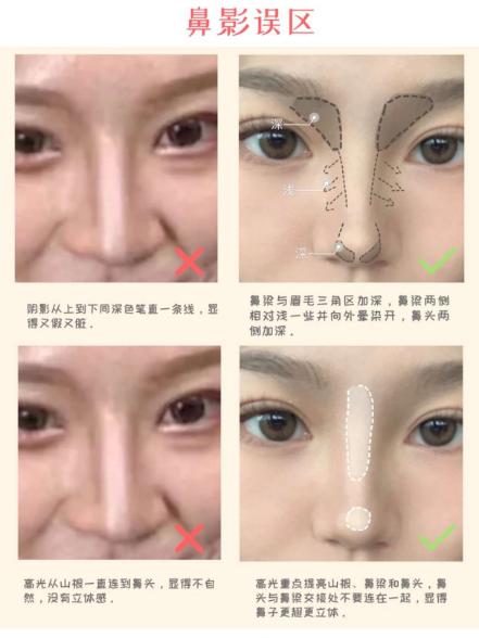 女生脸上常见的问题,女生脸上皮肤差如何改善