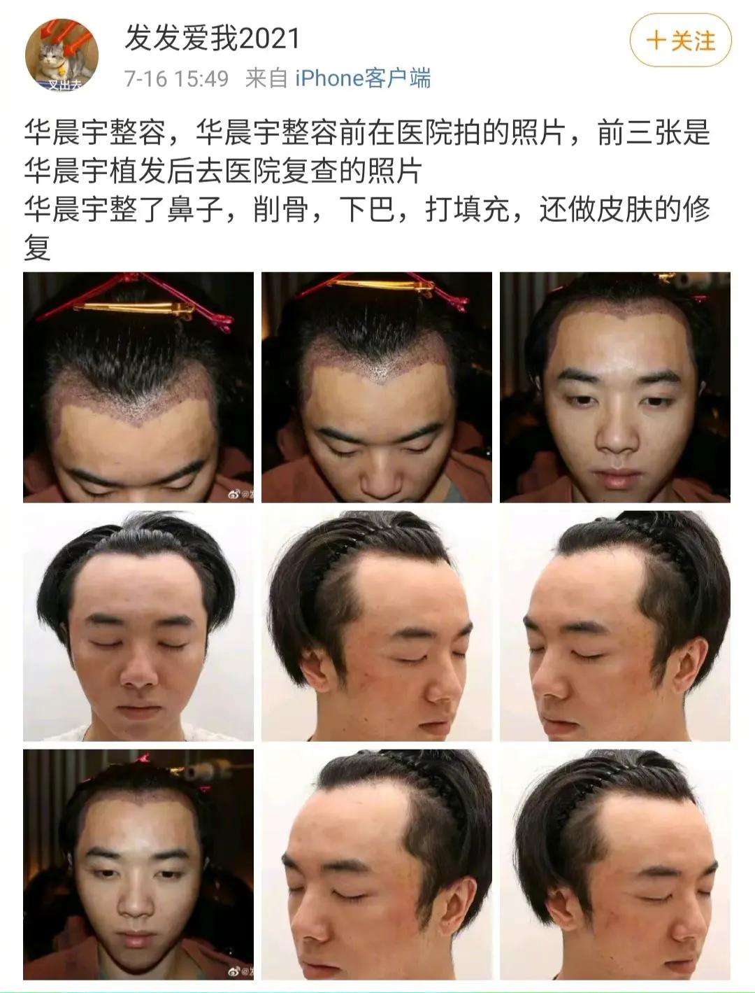 两极反转？爆料华晨宇整容出轨博主道歉了