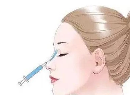 鼻整形应该选择什么样的医生,鼻整形有哪些术式