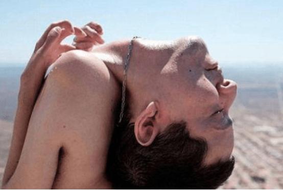 重庆男子怪病弯曲180度治好了,男子脊椎弯曲180度