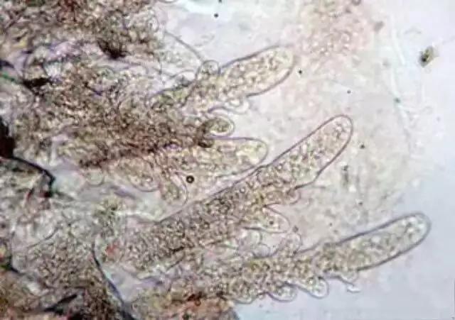 对虾养殖放苗前准备工作,对虾放苗时如何抗应激