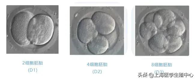 移植囊胚不容易宫外孕,移植胚胎级别不好容易胎停吗