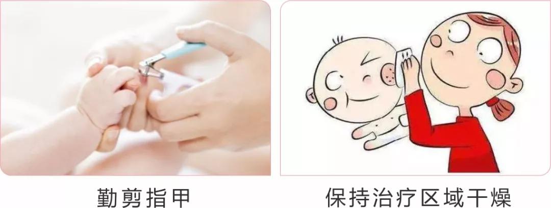 婴幼儿血管瘤怎么防护,血管瘤宝宝怎样护理皮肤