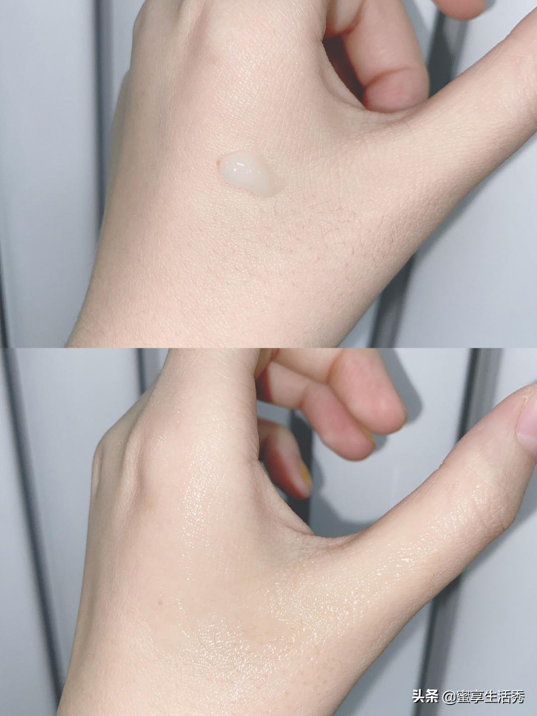 内双眼皮手术变外双效果,内双眼皮怎么变外双按摩最有效