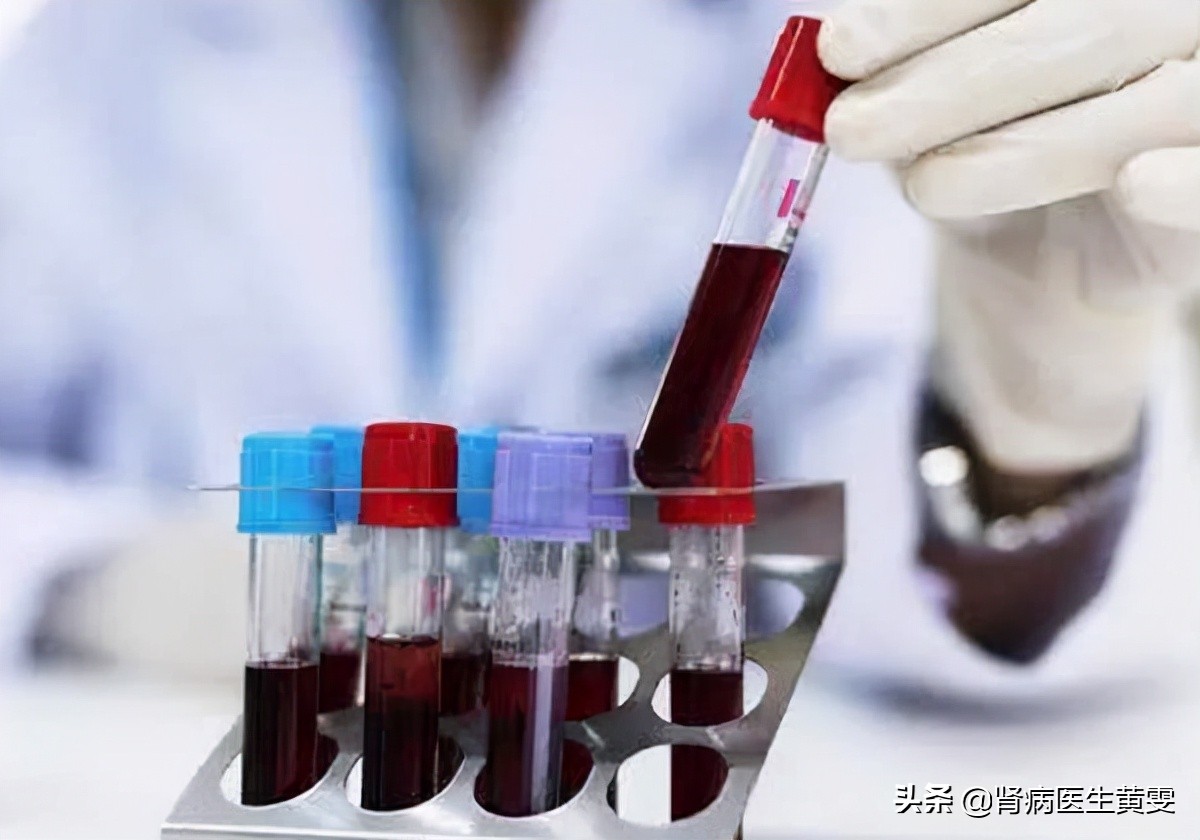 肾病肌酐900为啥不透析？中西医用药降肌酐，这些方法稳定肾功能