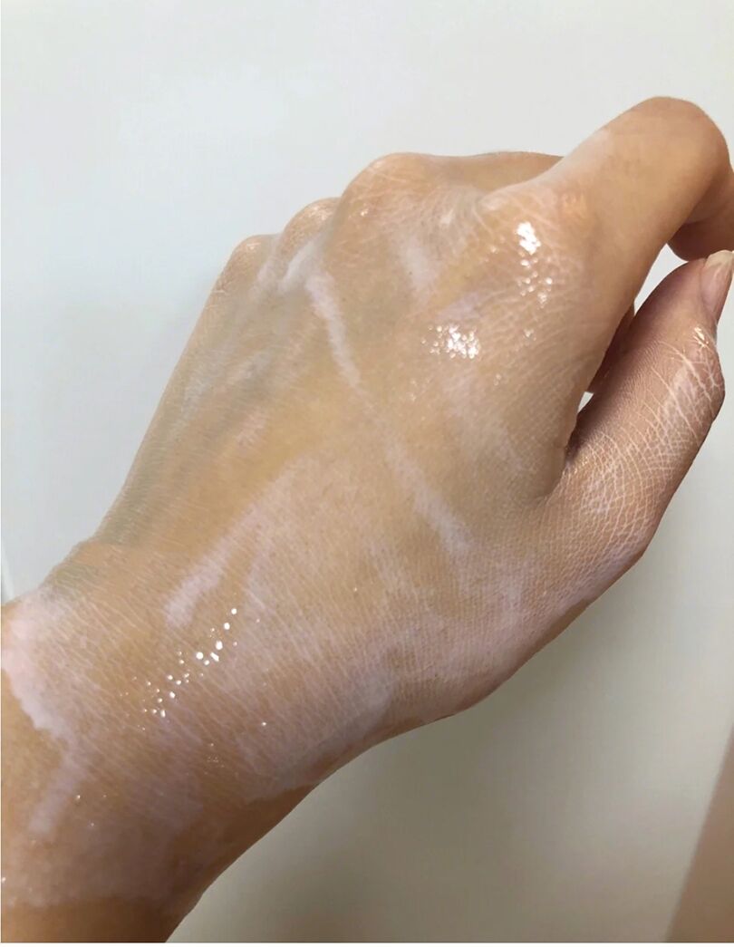 混油皮闭口卸妆油推荐,闭口敏感用什么卸妆油