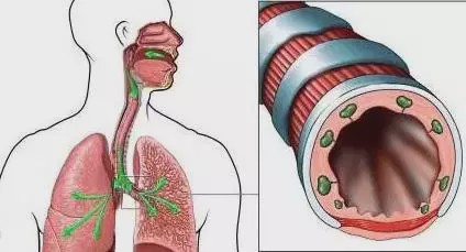 土蜂蜜加白萝卜有什么功效,萝卜煮蜂蜜的功效与作用是什么