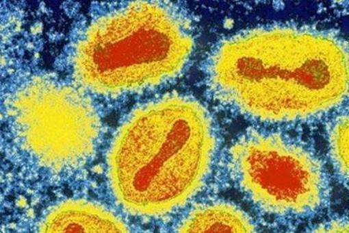 天花是人类唯一战胜的病毒,天花为什么是唯一灭绝的病毒