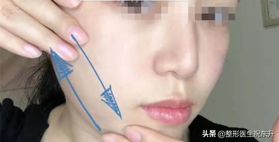 学会这些小技巧法令纹统统不见,怎么去法令纹中的表情纹