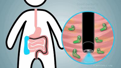 专家益生菌推荐测评,四大天王益生菌测评