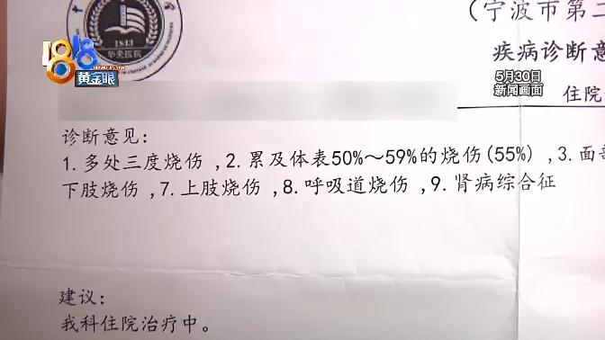 烫伤后不要过于紧张,烫伤后紧急处理