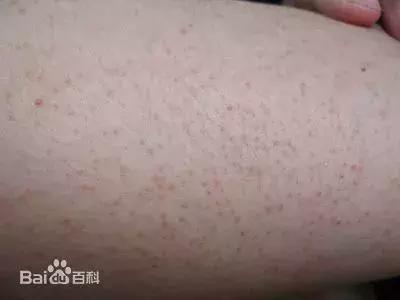 维生素应该怎么补才是最正确的,别乱补维生素c