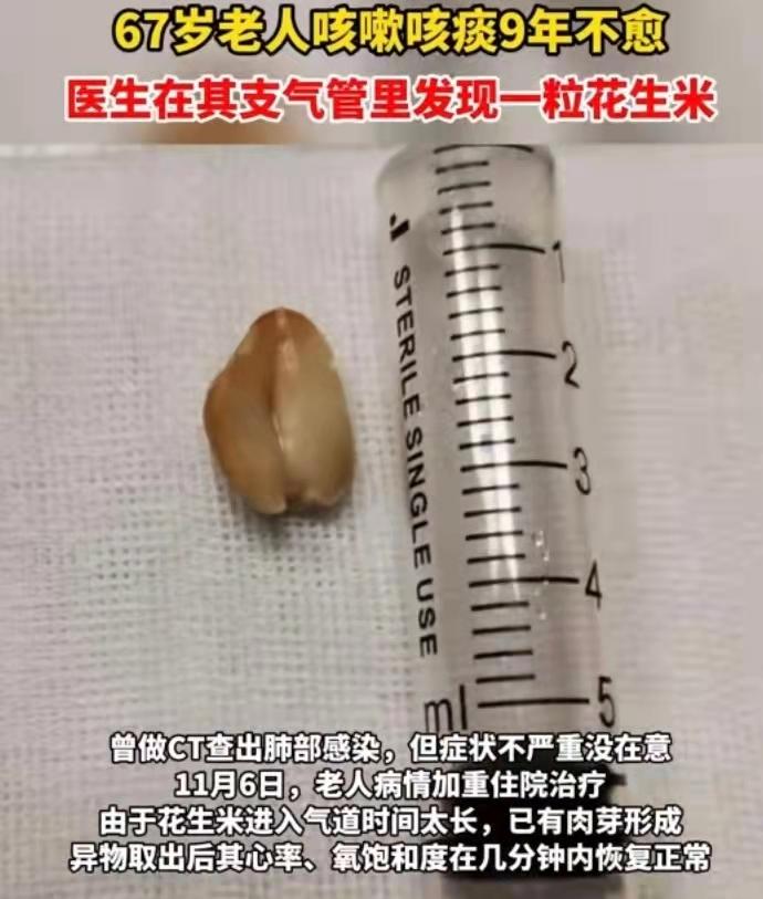 久咳不愈呼吸咽部有阻碍,久咳呼吸不畅是什么原因