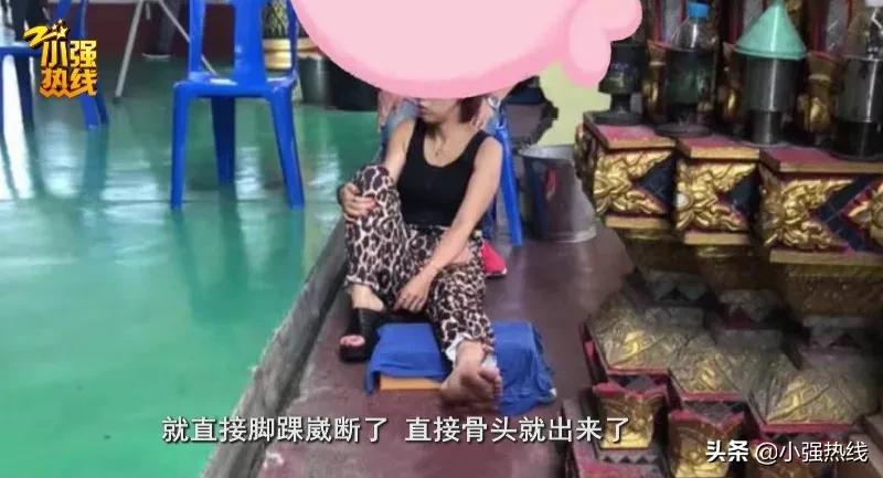 浙江女子出国游崴断脚踝拆钢板费用无法理赔