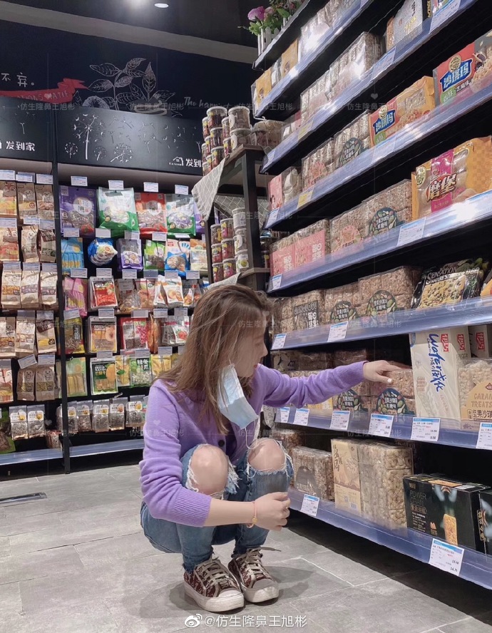 假体隆鼻耳软骨垫鼻尖图片,l型假体耳软骨隆鼻图片