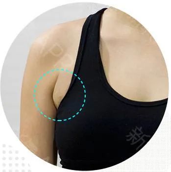 长期穿内衣影响哺乳吗,长期穿内衣会下垂吗