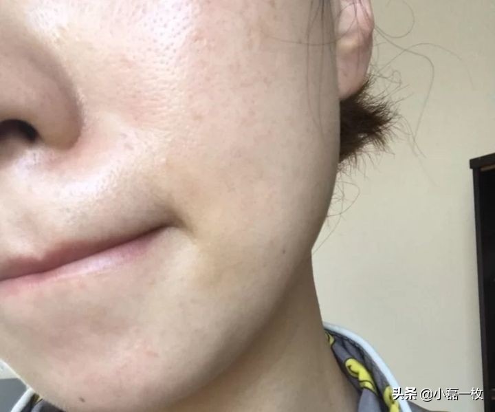 有哪些好用的祛痘印的产品,有哪些比较好的祛痘印产品