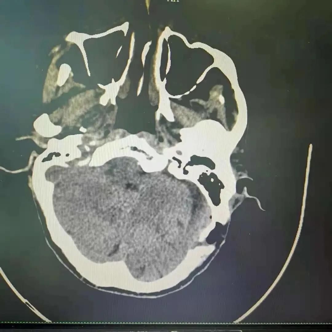天下第一痛,什么是天下第一痛
