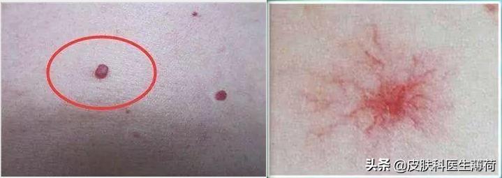 妊娠后皮肤痒,孕早期长痘化妆品能用吗