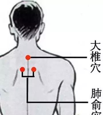怎么样能看出自己是寒湿,什么是寒湿症状有哪些
