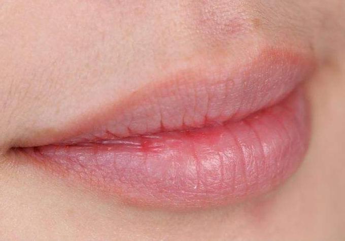 嘴唇干燥起皮用什么润唇膏最好,为什么涂了润唇膏嘴巴容易起皮