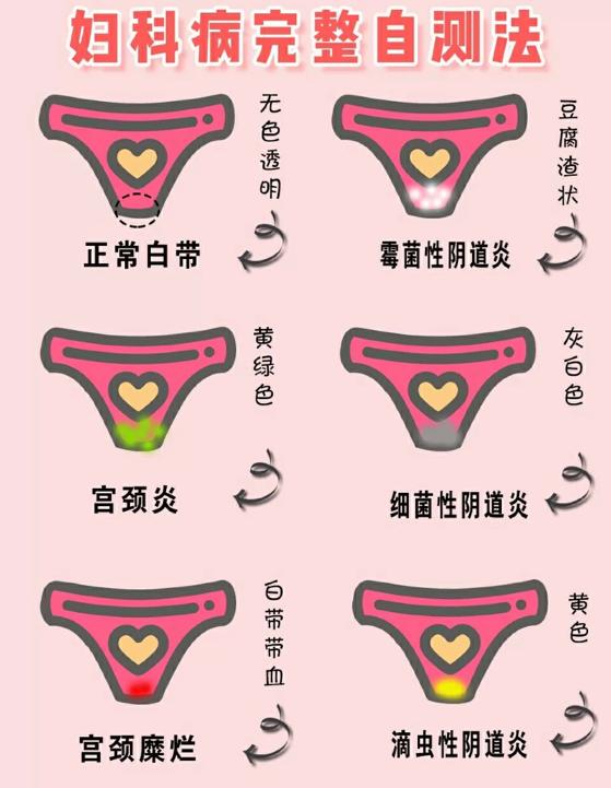 注意这几点防止霉菌反复发作,防止妇科炎症的6个坏习惯