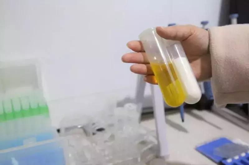 巴中学校食品安全问题,资阳学校食品安全检查报告