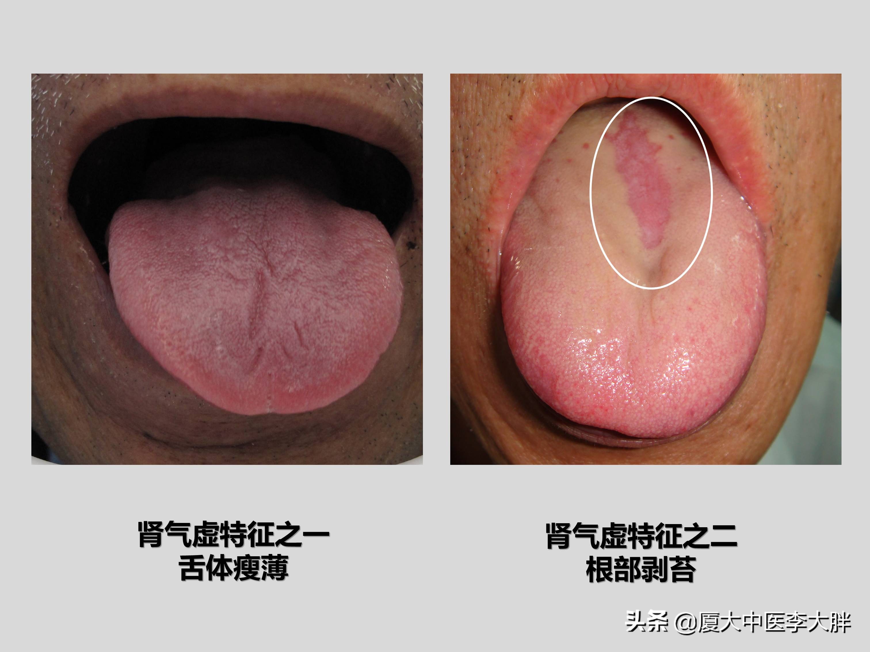 体虚多汗浑身乏力怎么调理,困乏多汗气虚怎么办