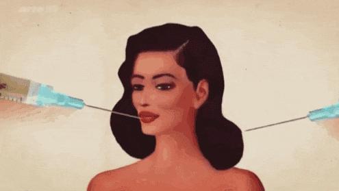 玻尿酸打完变美,把全脸的玻尿酸溶了