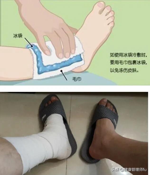 有人容易崴脚,护踝真的可以预防崴脚吗