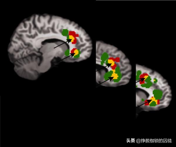 失恋为什么会产生心痛的感觉,失恋为什么会心痛医学解释
