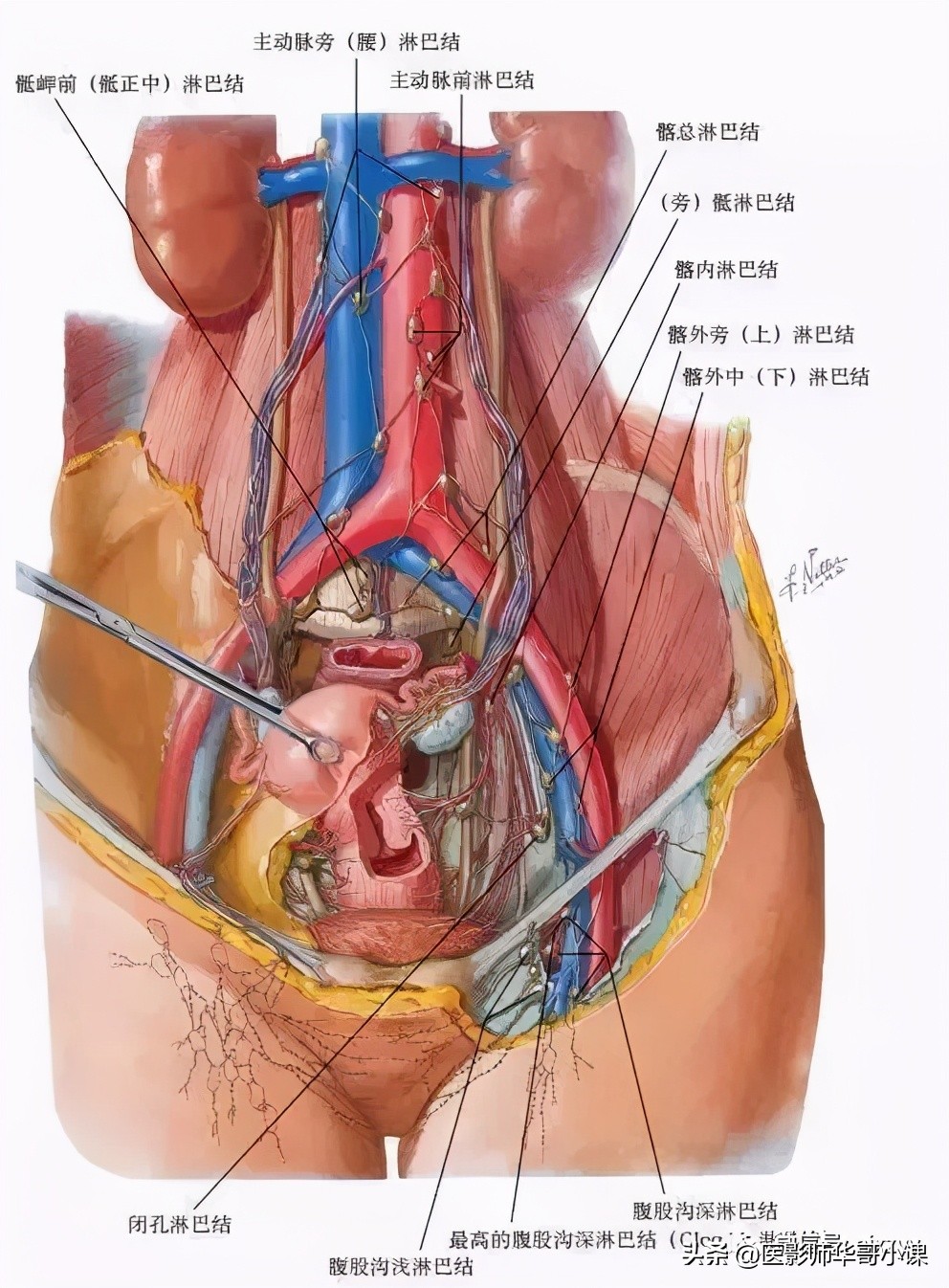 盆腔动脉血管解剖图谱,盆腔解剖图谱手绘