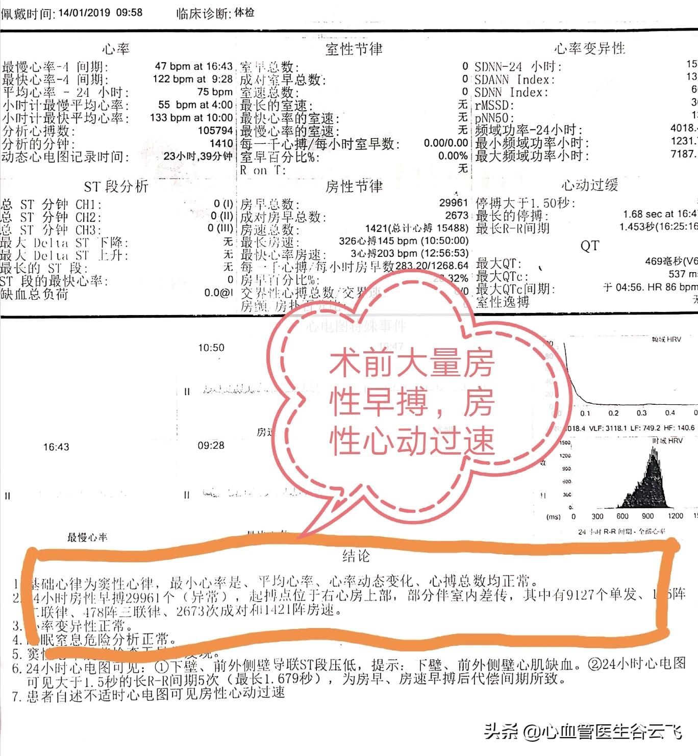 心律失常频发房性期前收缩,心律失常门诊故事