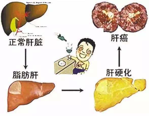 间充质干细胞能治肝纤维化吗,干细胞治疗肝硬化的最新研究
