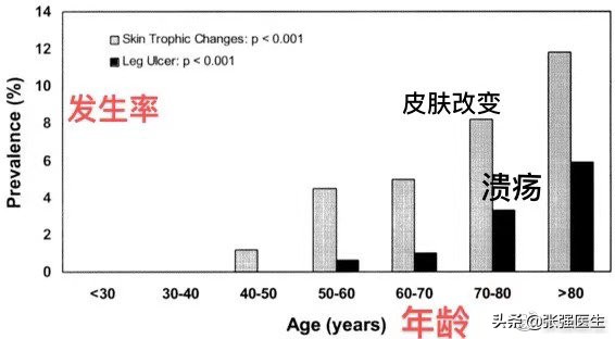 胃静脉曲张破裂前有什么征兆,老人静脉曲张严重怎么治疗最好