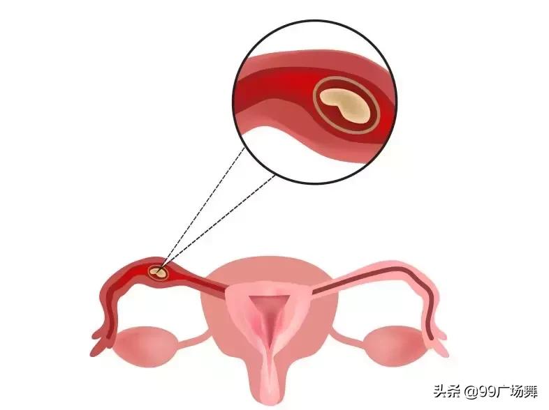 在高三儿子抽屉发现避孕套，这位爸爸竟选择......