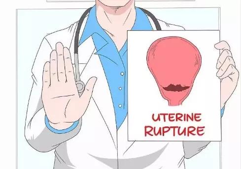 郑嘉颖老婆两年剖两胎？这样很危险