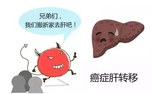 结肠癌肝转移按照肠癌还是肝癌治,肠癌肝转移化疗无效怎么办