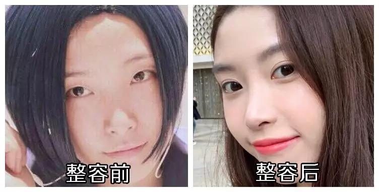 想做双眼皮是不是得检查下视力,想做双眼皮攻略