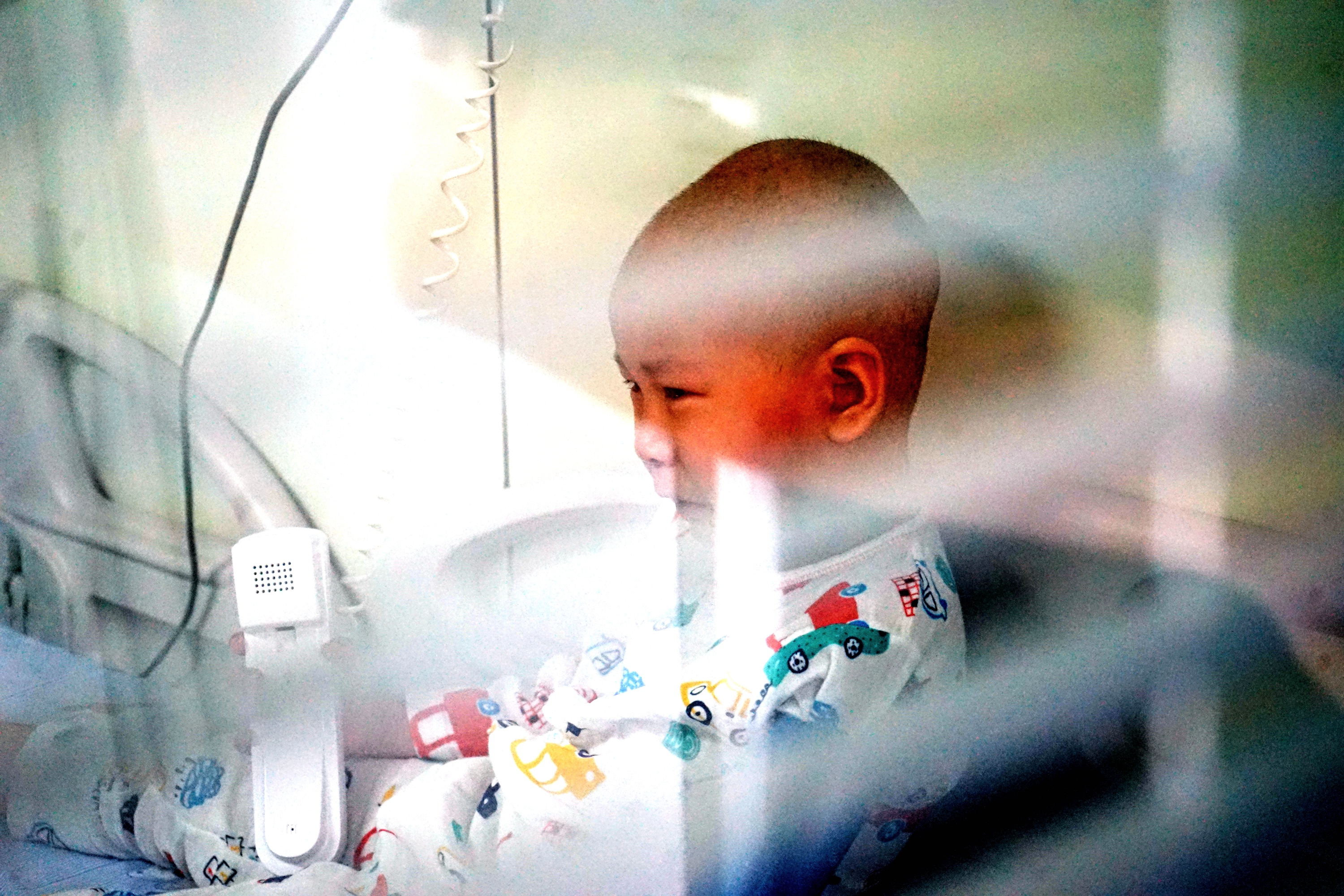 湖北4岁女孩生病致脸部毁容，需“割肉”治疗，爸爸门外放声大哭