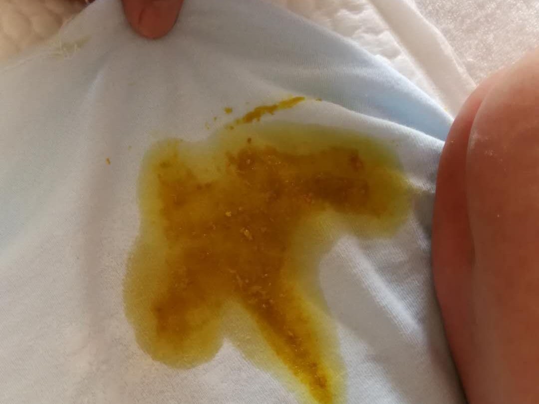 月子里的宝宝放屁拉稀是感冒了嘛,月子里宝宝吃母乳为什么拉稀频繁