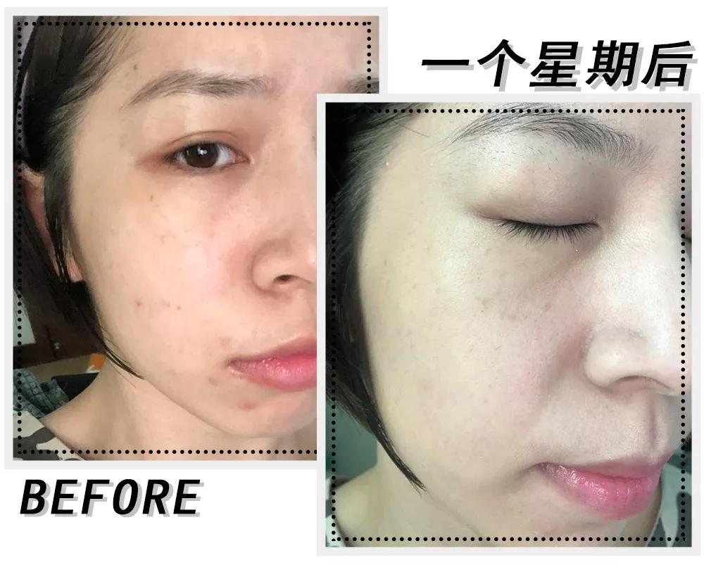 美白淡斑国货面膜推荐,国货平价面膜推荐美白