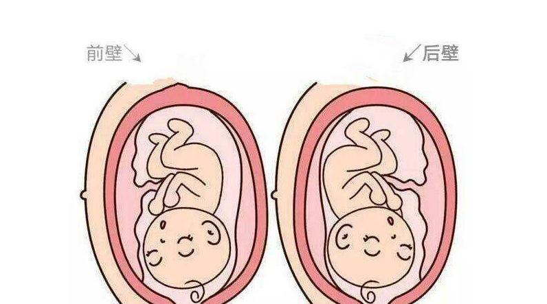 前壁好生还是后壁好生,前壁后壁哪个更容易顺产