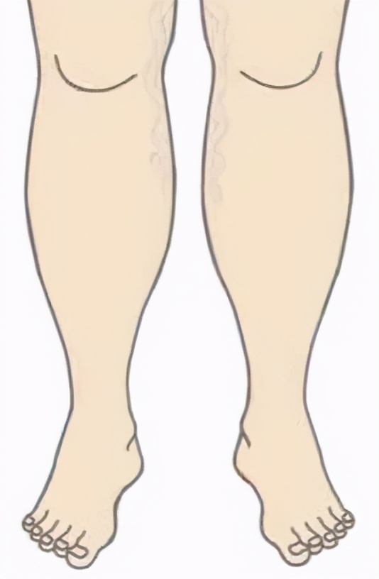 西安红会医院心血管住院部,西安市红会医院心血管内科地址