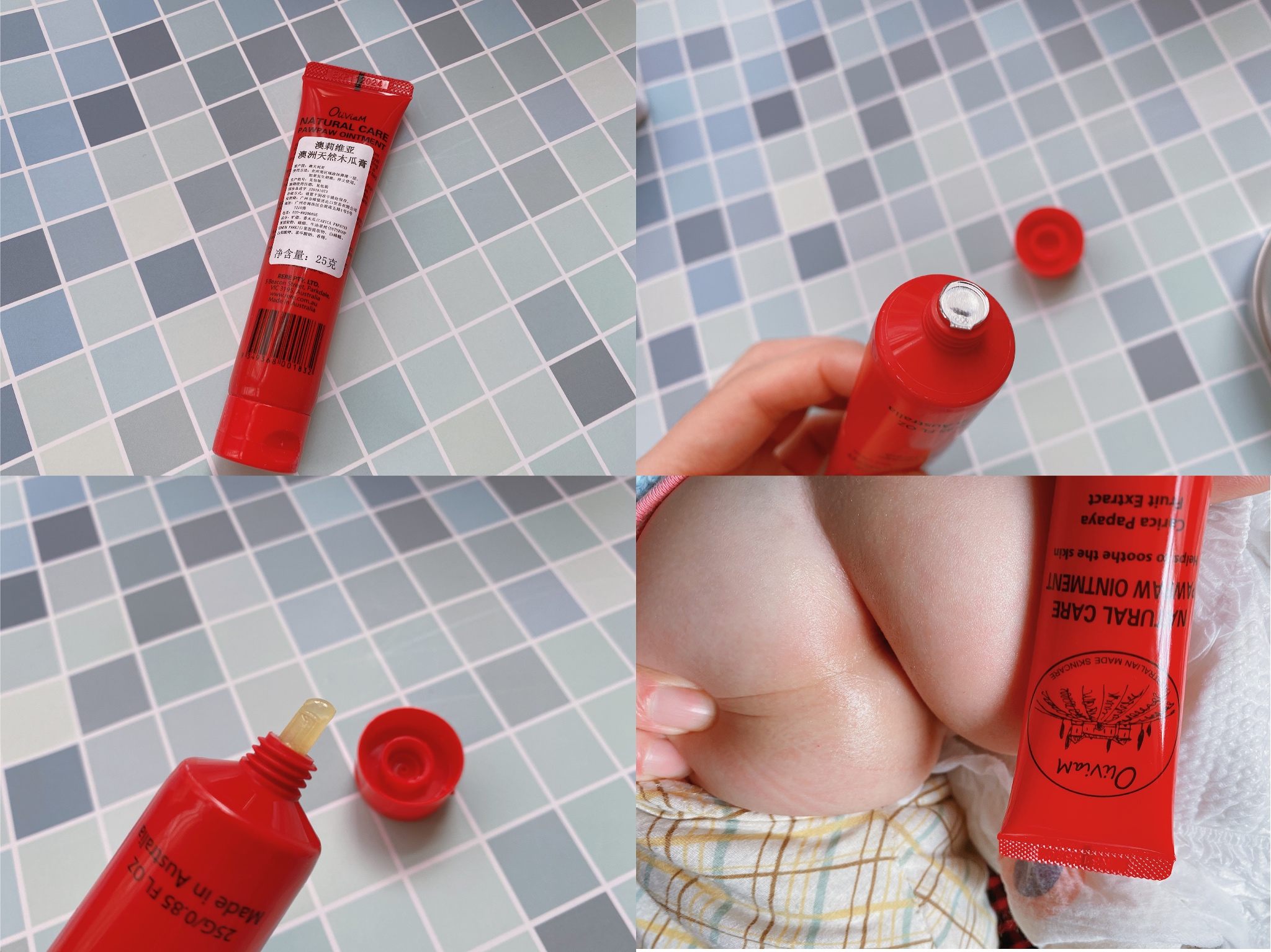 澳洲木瓜膏可以祛痘消炎吗,木瓜膏祛痘疤