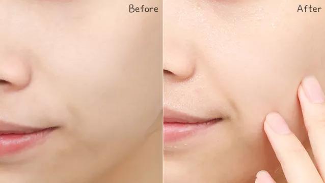 敏感肌换季好物,敏感肌水乳抗皱天花板