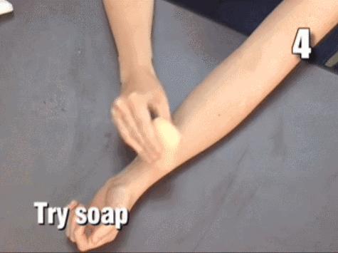 蚊子咬了用什么药膏止痒最快,蚊子咬了用什么药膏止痒快