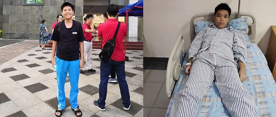 高考考生动手术,高考前查出脑瘤考600分