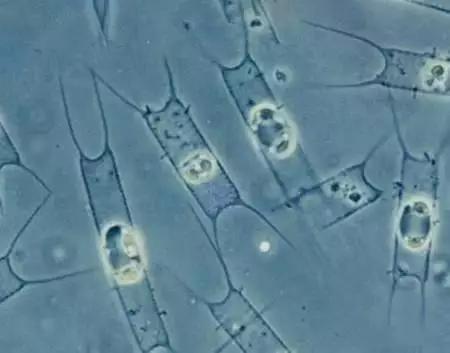 鱼类水产养殖需要哪些藻类,水产养殖显微镜下各种藻类