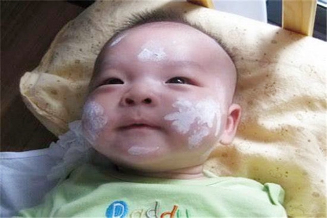 宝宝湿疹难缠,宝宝湿疹又着急又心疼
